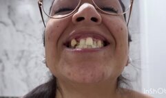 LOOK AT MY MOUTH, CROOKED TEETH, TONGUE AND BUBBLE GUM