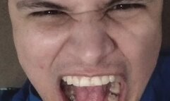 Silly dude doing stupid scary faces and showing my teeth