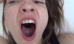 HORRIBLE MORNING BAD BREATH 4 M