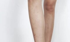 Flattened and inserted