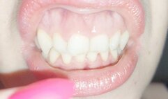 My gums are inflamed