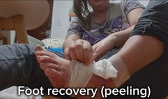Foot Recovery Ritual – Chubby Girl Removes Bandage, Reveals Healing Foot and Eats Skin – Foot Fetish, Wound Care, Gross Kink