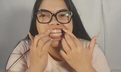 Woman with glasses shows you how her yellow teeth look