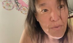 See my Buccal Fistula - I need a root canal (July 25 2025)