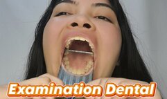 Examination Dental: Yellow teeth, cavities