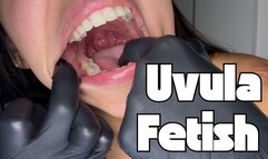 Úvula + Examination with gloves