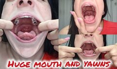 Huge mouth and yawns