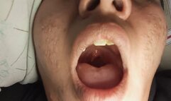 Yawning Close-Ups – Mouth, Breath & Uvula