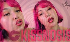 KISSNOSIS