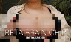 BETA BRAIN CHIP INSTALLATION