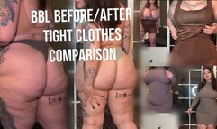 BBL Tight Clothes Comparison Before and After Surgery