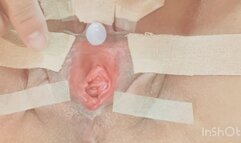 Masturbation that gives continuous pleasure to the clitoris.