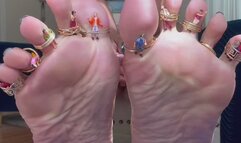 Tinny Trapped Between My Toes