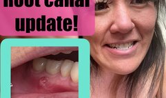 Just brushing my teeth and discussing my pending ROOT CANAL on Tooth #46 (oct 6 2025)