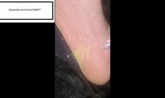 Velvet just picking away and itching feet