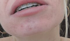 Stinky yawnsing! MP4