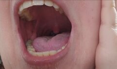 Close-Up of My Wet Throat and Open Mouth with Tongue and Yellow-Stained Teeth – Fetish for Spit, Gag Reflex and Throat Play