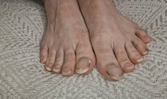 A Detailed Investigation of My Neglected Feet