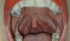 Uvula Movements