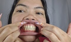 Pervert shows her dirty yellow teeth: tooth fetish