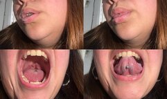 Saliva bubbles, very wet mouth