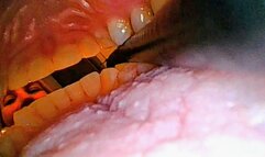 YOU Looking Out! Borescope with Penny!