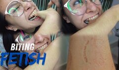 Biting fetish
