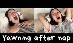 Yawning after a long nap!