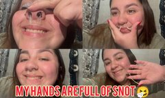 My hands are full of snot