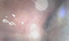 Deep in Bailey's Throat (New Endoscope Footage)