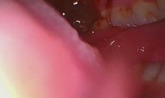 Borescope inside chewing biting teeth at work