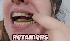 AFTER BRACES I NEED TO USE THIS RETAINERS