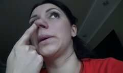 spreading of the nostrils a