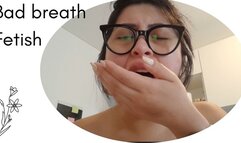 BAD BREATH , WHITE TONGE AND DIRTY TEETH