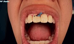 Just food stuck to her teeth! GM mouth views, tiny trapped on tongue! - MP4