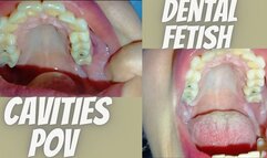 Pov. Crooked and decayed teeth