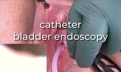 catheter bladder endoscopy