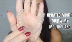 Updated mouth tour and my mouthguard - OnlyVanessa