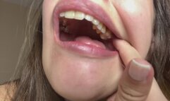 Dental Mirror Deep in My Mouth – Extreme Close-Up Teeth Inspection POV