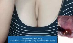 Endoscopic swallowing: view of the journey of the jelly bean from the mouth to the stomach