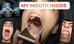 My mouth inside