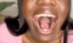 Whipped Cream Spitting