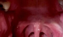 3D VIBRATING UVULA