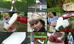 Yvette Term SLWC Gimping in the Park in Short and Showing Off Her Casted Toes (in HD 1920X1080)