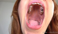 Redhead Titi's Extreme Mouth Tour – Huge Lips, Missing Tooth & Dancing Uvula (FULLHD resolution)