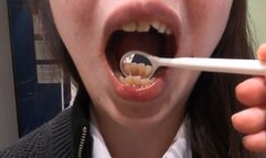Real Amateur – Beautiful Married Woman’s Detailed Dental Checkup (Extreme Mouth Close-Up)