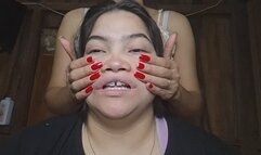Facial exercises for her distorted face in slow motion