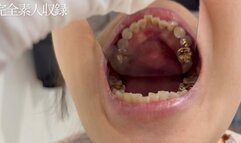 Amateur , Oral Fetish – It’s a Miracle to See This. A 20-Year-Old with Gold Teeth, Completely Recorded in Full Detail.