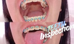 Dental exam while wearing braces