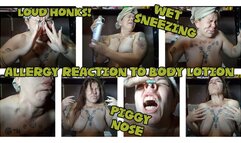 MADNESS ALLERGY REACTION TO BODY LOTION